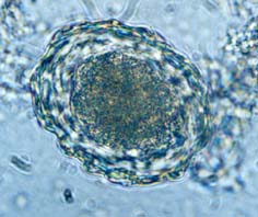 Nematoda - The excretory systems of different phylum types